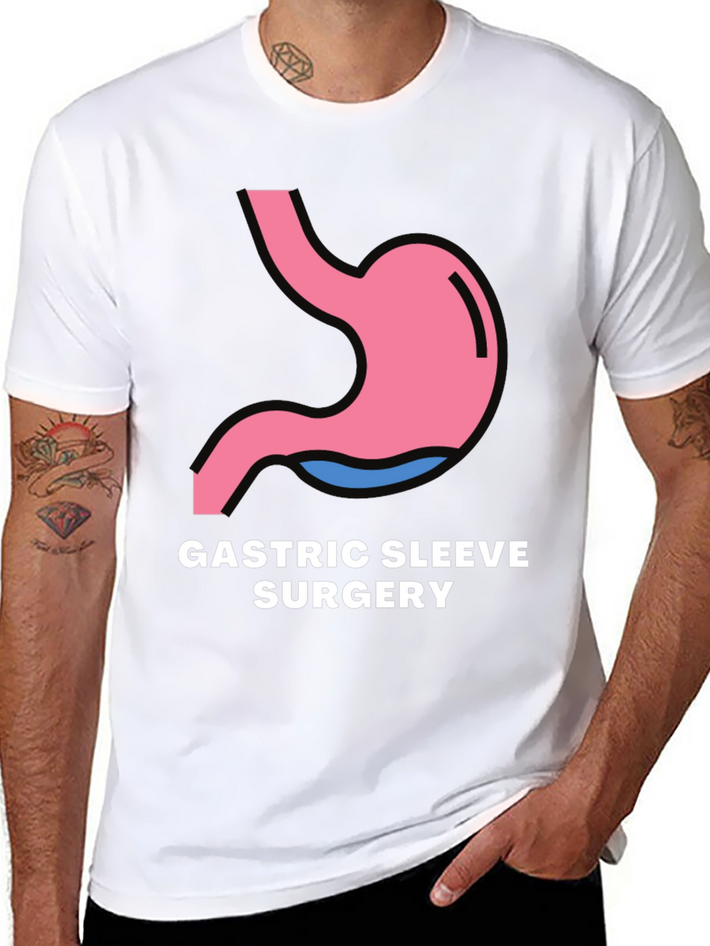 Gastric Sleeve Surgery Graphic Tee - Black T-Shirt